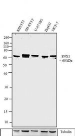 SNX1 Antibody in Western Blot (WB)