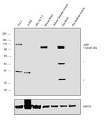 Amyloid Precursor Protein Antibody in Western Blot (WB)