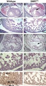 NCoR2 Antibody in Immunohistochemistry (IHC)