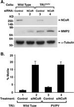 NCoR1 Antibody in Western Blot (WB)