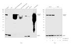 Transferrin Antibody