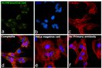 TIM-1 Antibody in Immunocytochemistry (ICC/IF)