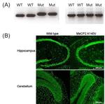 MECP2 Antibody in Immunohistochemistry (IHC)