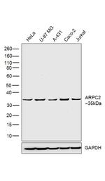 ARPC2 Antibody in Western Blot (WB)