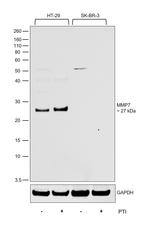 MMP7 Antibody in Western Blot (WB)