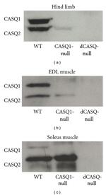 Calsequestrin Antibody in Western Blot (WB)