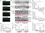 Calsequestrin Antibody in Western Blot (WB)