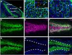 PMCA2 ATPase Antibody in Immunocytochemistry (ICC/IF)