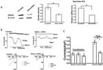 alpha-ENaC Antibody in Western Blot (WB)