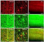 Parvalbumin Antibody in Immunohistochemistry (IHC)