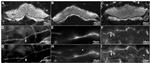 Parvalbumin Antibody in Immunohistochemistry (IHC)