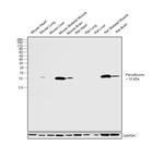 Parvalbumin Antibody in Western Blot (WB)