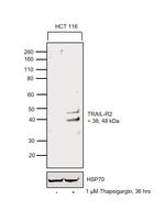 TRAIL-R2 (DR5) Antibody in Western Blot (WB)