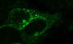 CXCR7 Antibody in Immunocytochemistry (ICC/IF)