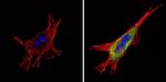 SSTR4 Antibody in Immunocytochemistry (ICC/IF)