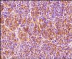 HIF1A Antibody in Immunohistochemistry (Paraffin) (IHC (P))