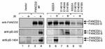 Phospho-FANCD2 (Ser222) Antibody in Western Blot (WB)