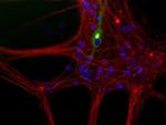 NEFL Antibody in Immunocytochemistry (ICC/IF)