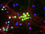 NEFM Antibody in Immunocytochemistry (ICC/IF)