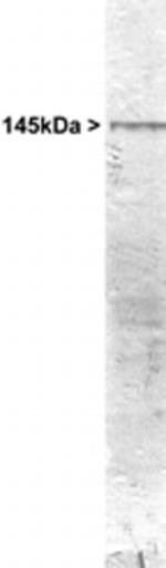 NEFM Antibody in Western Blot (WB)