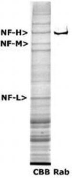 NF-H Antibody in Western Blot (WB)