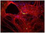 alpha Internexin Antibody in Immunocytochemistry (ICC/IF)