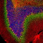 alpha Internexin Antibody in Immunohistochemistry (Paraffin) (IHC (P))