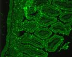 SSTR2 Antibody in Immunohistochemistry (Paraffin) (IHC (P))