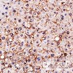 SR-BI Antibody in Immunohistochemistry (Paraffin) (IHC (P))