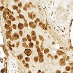 PLTP Antibody in Immunohistochemistry (Paraffin) (IHC (P))