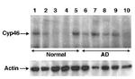 CYP46A1 Antibody in Western Blot (WB)