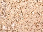 NuMA Antibody in Immunohistochemistry (Paraffin) (IHC (P))