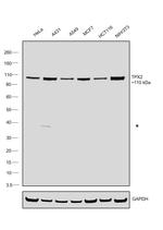 TPX2 Antibody in Western Blot (WB)