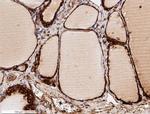 Calreticulin Antibody in Immunohistochemistry (Paraffin) (IHC (P))