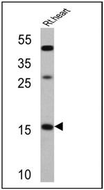 ANP Antibody in Western Blot (WB)