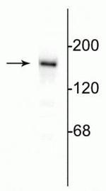 NMDAR2B Antibody in Western Blot (WB)