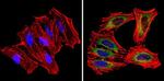 mDIC Antibody in Immunocytochemistry (ICC/IF)