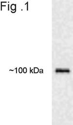 E6AP Antibody in Western Blot (WB)