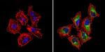 IGF2R Antibody in Immunocytochemistry (ICC/IF)