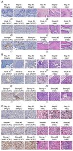 CXCR7 Antibody in Immunohistochemistry (IHC)