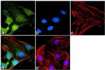 CXCR7 Antibody in Immunocytochemistry (ICC/IF)