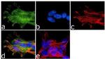 NMDAR1 Antibody in Immunocytochemistry (ICC/IF)