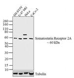 SSTR2 Antibody in Western Blot (WB)