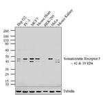 SSTR5 Antibody in Western Blot (WB)