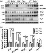 PLP1 Antibody in Western Blot (WB)