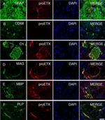 PLP1 Antibody in Immunocytochemistry (ICC/IF)