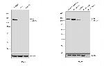 NEFM Antibody in Western Blot (WB)