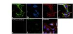 NEFM Antibody in Immunocytochemistry (ICC/IF)