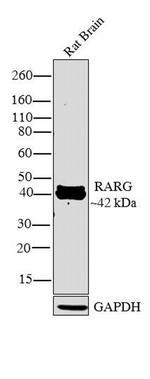 RAR gamma-1 Antibody in Western Blot (WB)