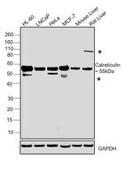 Calreticulin Antibody in Western Blot (WB)